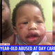 Image for article titled Indiana Day Care Shut Down After Brutal Attack on 1-Year-Old